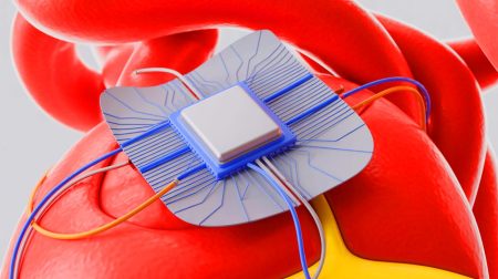 Illustration of a revolutionary paper-thin patch adhering to an organ for enhanced drug delivery (AI-generated, unrealistic). Credit: Ideogram.
