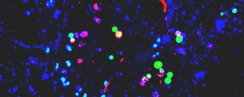 Nanoplastics in the brain may promote Parkinson’s disease