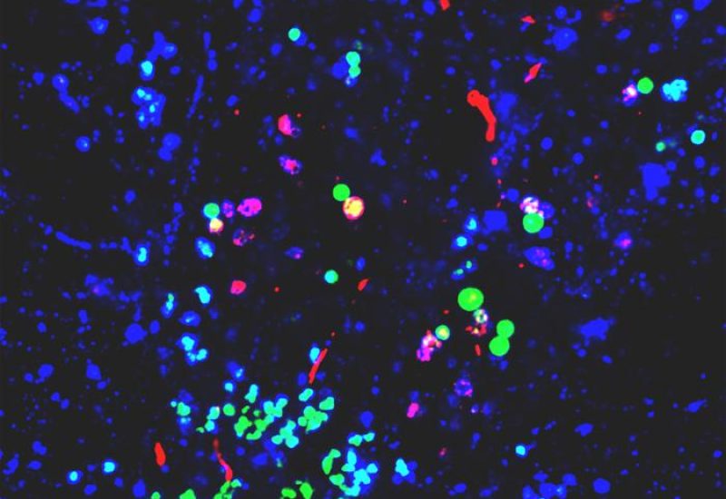 Nanoplastics in the brain may promote Parkinson’s disease