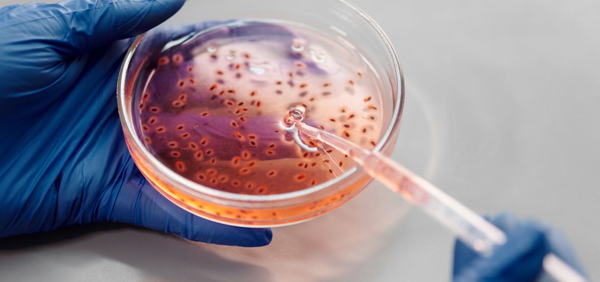 Air pollution may worsen antibiotic resistance in pathogens